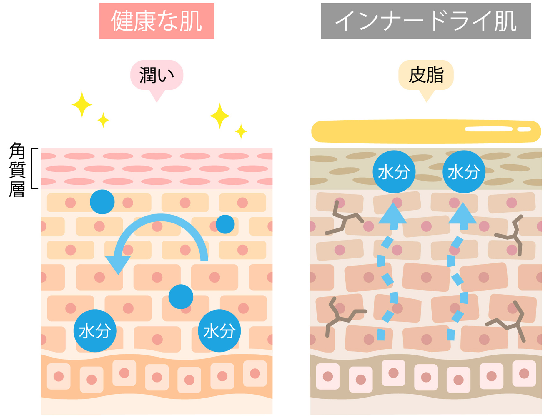 インナードライ肌のイメージ