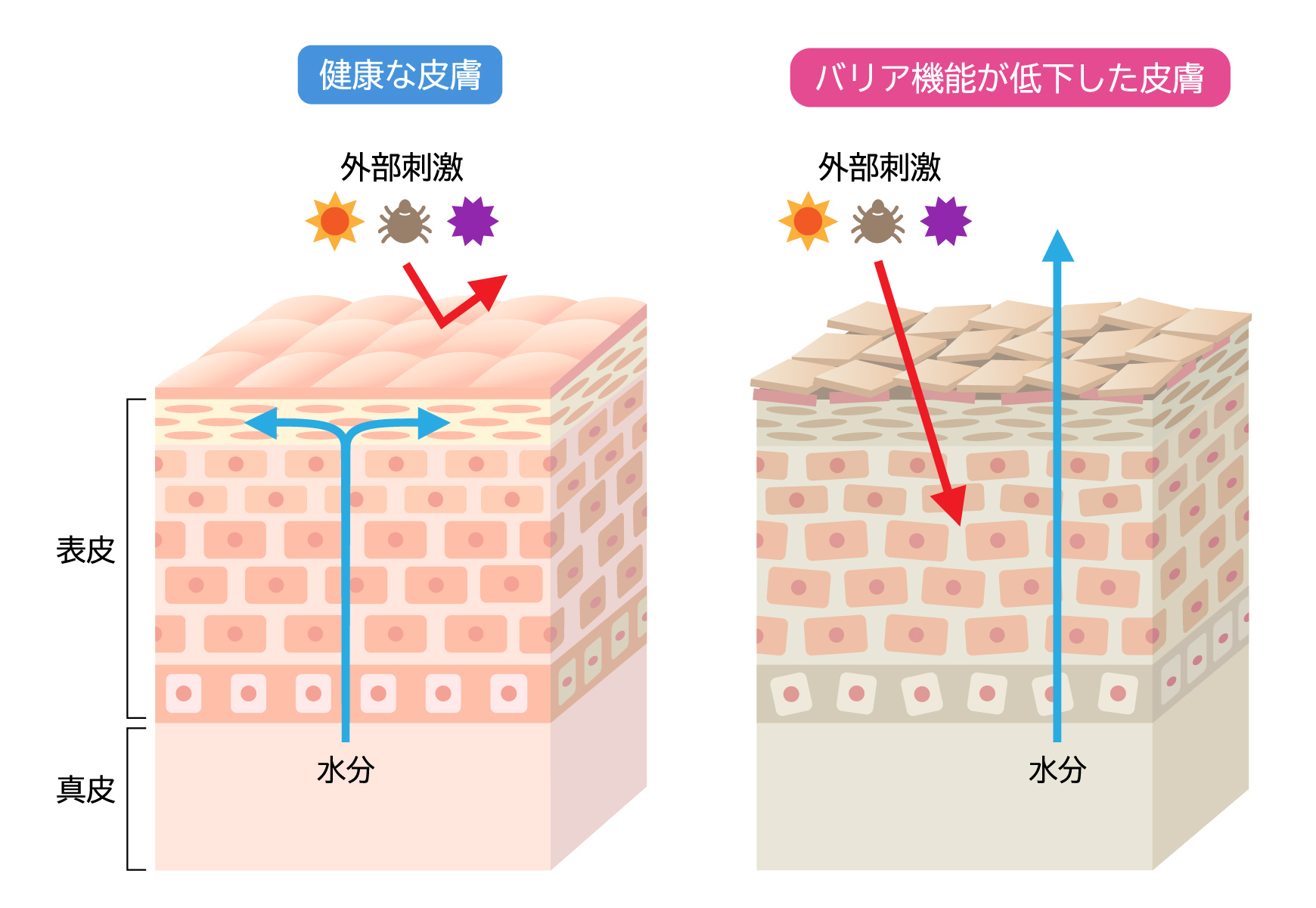 健康な皮膚とバリア機能が定価した皮膚の違いを表したイメージ