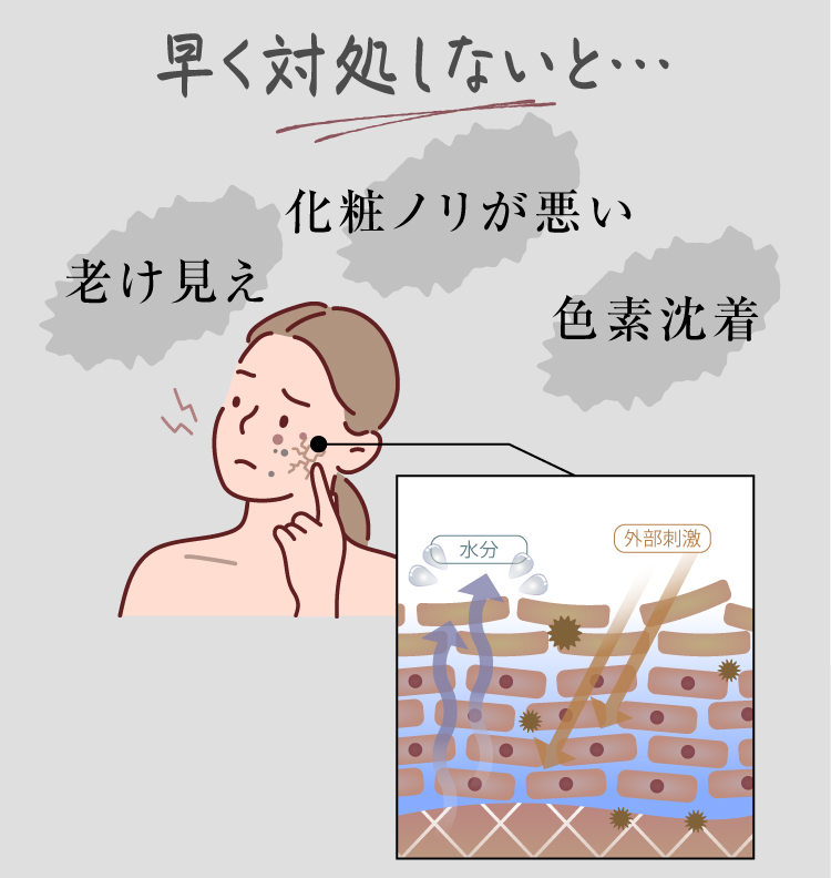 早く対処しないと&hellip;「化粧ノリが悪い」「老け見え」「色素沈着」など悪影響が多数！